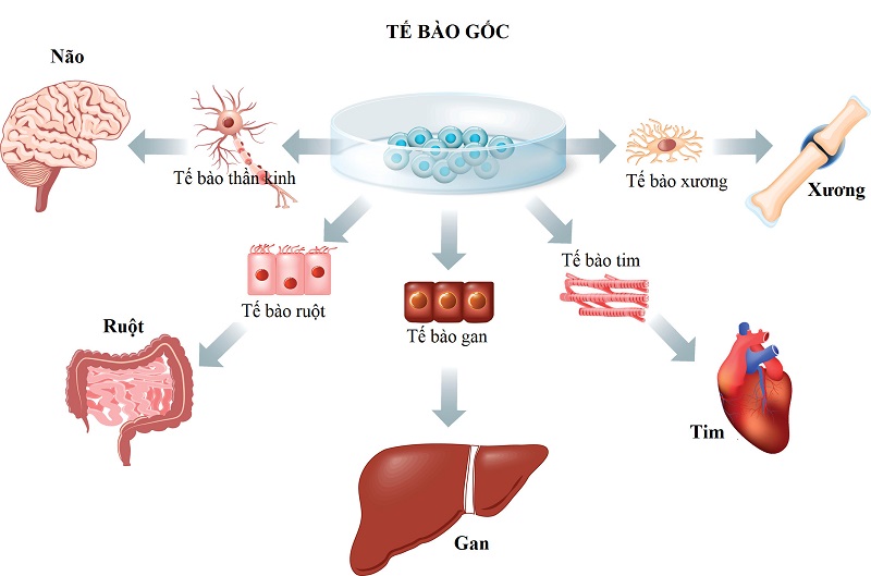 Ghép tế bào gốc để điều trị bệnh đa u tủy xương